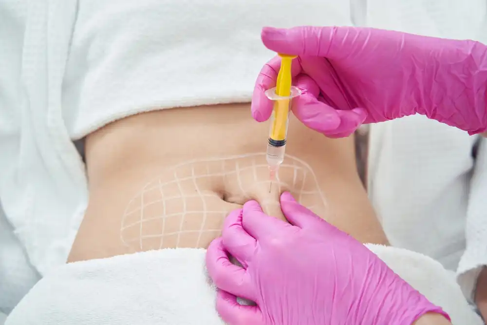 Do-Adipose-Lipolysis-69901dd43acdd-1 Do Adipose Lipolysis Injections Work for Belly Fat?