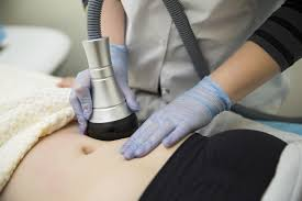 How-Is-Laser-Liposuc-69a2b0737e17f-1 How Is Laser Liposuction Different from Traditional Liposuction in Islamabad?