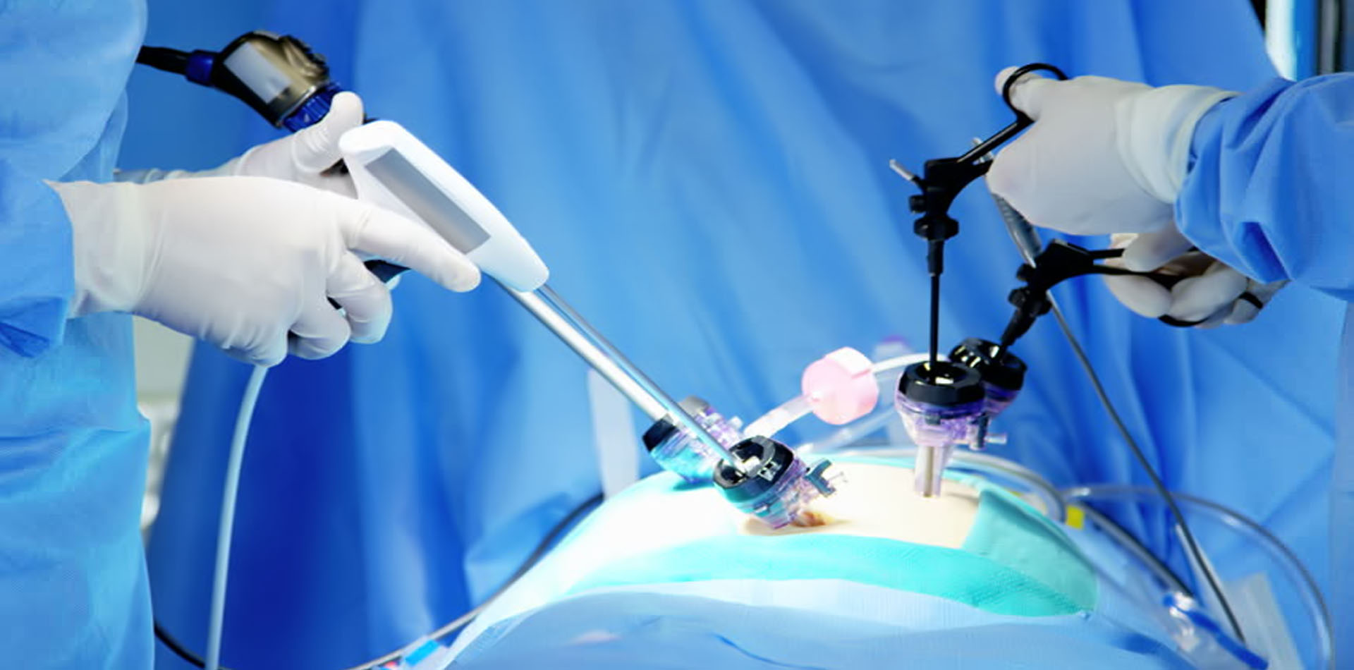 Private: Laparoscopic-Surgery-in-Islamabad-0.jpg
