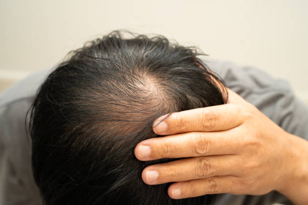 Private: PRP-Hair-Treatment-in-Riyadh-7.jpg