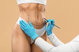 Private: Plastic-Surgery-in-Dubai-4.jpg